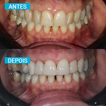 Antes e Depois 8