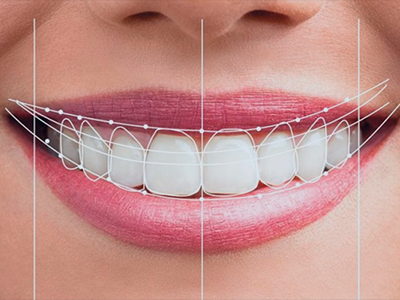 Teste do Sorriso